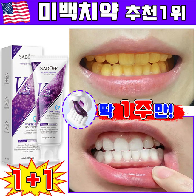 미백 치약 추천1위 미백치약 화이트닝 치약 치아 미백치약 누렁니 미백 치약 입냄새제거 구취제거 치아미백 LUPEIYA, 2개, 100g