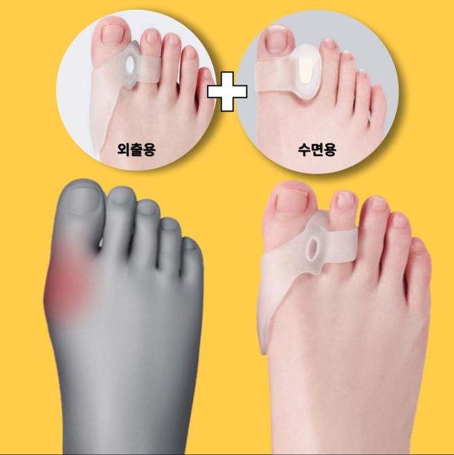 꿀템대장 단계조절 발가락 관리기 + 좌/우=1세트, 1개