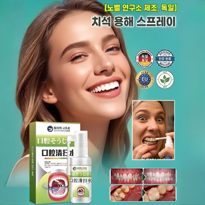 치석 용해 스프레이 입냄새제거 스프레이 황치제거 담뱃때제거 충치예방 잇몸출혈해결, 4개, 30ml