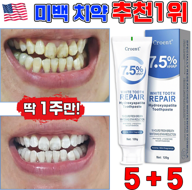 미백 치약 추천1위 치아 미백치약 화이트닝 치약 누렁니 미백 치약 입냄새제거 구취제거 치아미백 보장증정, 10개, 120ml