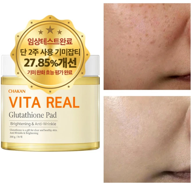 기미 잡티 주근깨 화이트닝 미백 비타민 글루타치온 토너 패드, 1개, 70매입 - 쿠팡