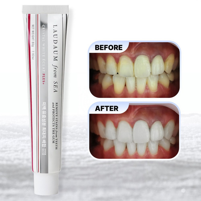 [로다움] 미백 치약 화이트닝 에끌라 플러스 치아 미백제 80g, 1개, 80ml