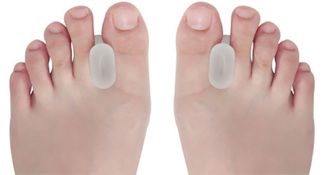 FC1901 실리콘 발가락벌리개 발가락분리대 발가락교정기 (2PCS/1팩), 1세트