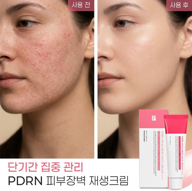 안티에이징 PDRN 피부장벽 재생크림 기미크림 나이아신아마이드 히알루론산 주름 개선 탄력 미백 보습 검버섯 주근깨, 1개, 50ml
