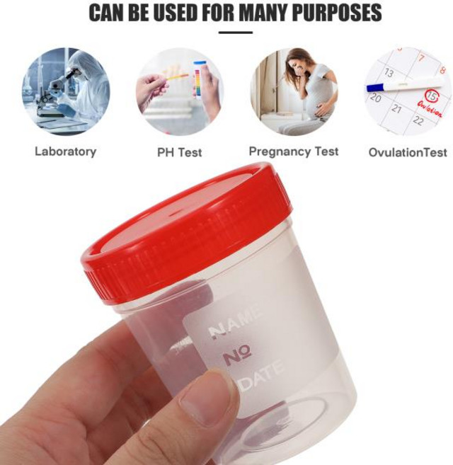 소변 컵 멸균 표본 플라스틱 샘플 테스트 용기 일회용 눈금 수집 S 병원, 한개옵션0