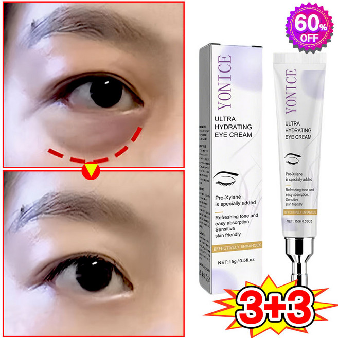 [피부과 추천] 1/1+1/2+2 눈밑지방 아이백 리프팅 아이크림 눈 밑 지방 제거 크림 아이백 크림 다크서클 눈밑꺼짐 제거 눈가 주름개선 LUPEIYA 포장증정, 6개, 15g