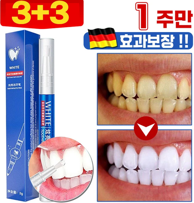 독일개발 화이트닝 셀프 치아 미백제 치아 미백 펜 겔 구강 위생 케어 입냄새 누렁니 얼룩 제거 프리미엄 3g, 6개 - 쿠팡