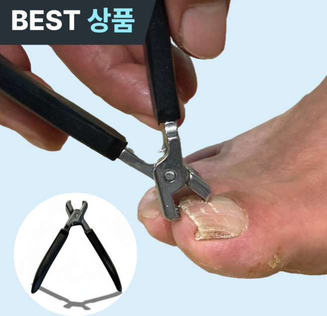 플러클 초강력 발톱깍이 내성 문제성 무좀, 1개, 딥블랙