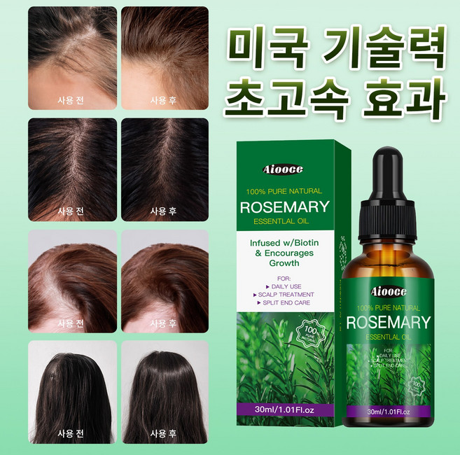 [탈모 케어] 미국기술 로즈마리 탈모앰플 머리 나는 탈모치료제 모발 성장 모낭 활력강화 발모제 두피 영양제 여성 탈모 앰플 두피앰플 두피에센스 스칼프 부스팅 앰플, 1개, 30ml