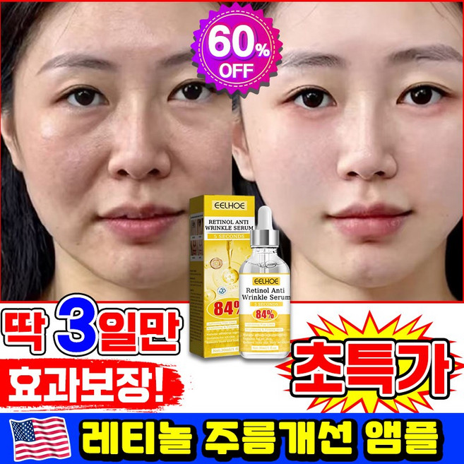 [3일 효과있음] 1/1+1/2+2 레티놀 앰플 레티놀원액100% 주름개선 에센스 모공수축 세럼 모공앰플 피부 리페어 미백 LUPEIYA 포장증정, 1개, 30ml