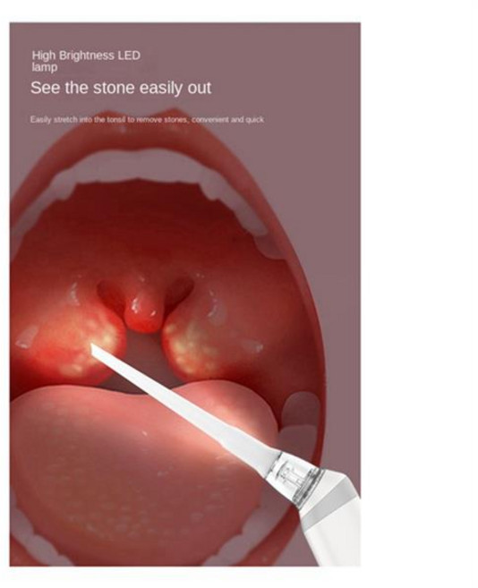 편도결석흡입기 편도결석치약 셀프치석제거기 ABVS 전자 편도선 제거 키트 제거제 진공 자동 구강 관리 입 청소기, [01] 옵션1, 1개