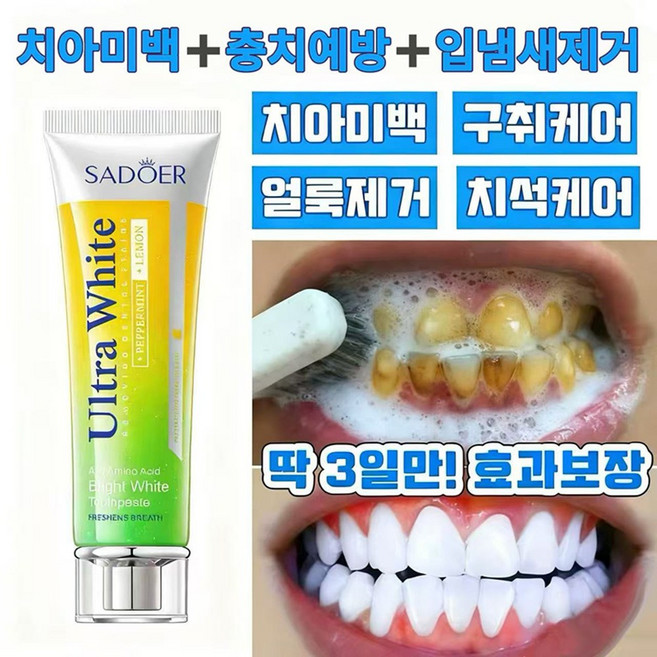 미백치약 치석제거 황치제거 담뱃때제거 충치예방 잇몸출혈해결 등 다양한 효능, 1개, 100ml