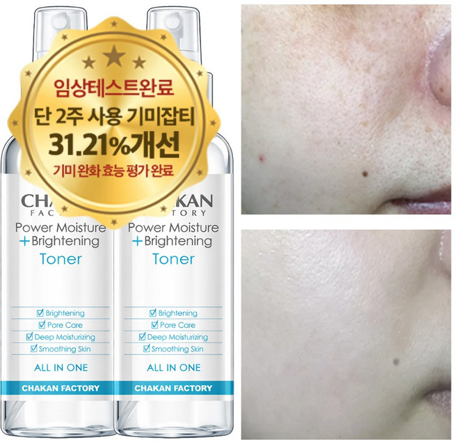 기미 잡티 주근깨 미백 색소침착 착색 검버섯 수분 보습 화이트닝 광채 기미잡티 미스트, 2개, 150ml