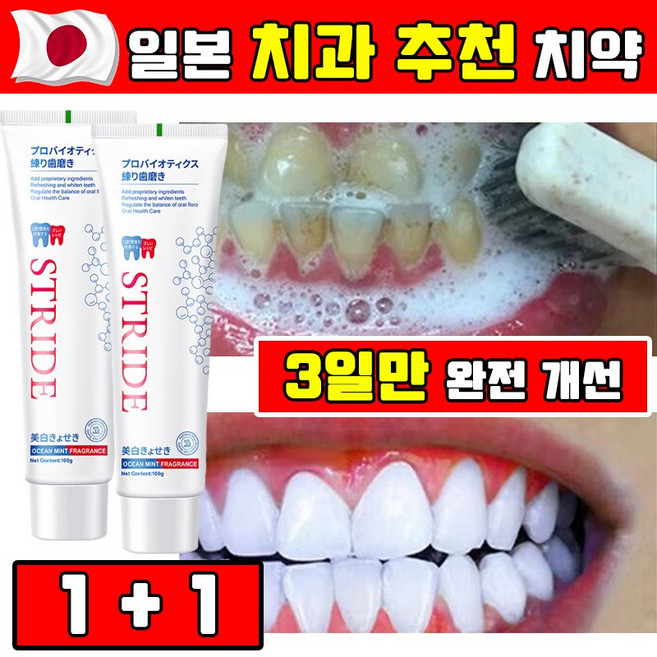 [강력 미백] 1/1+1/2+2 일본 누렁니 미백 치약 추천 1위 화이트닝 치약 입냄새 제거 치약 치석 제거 Stride 치솔 50개만 선착순!, 100g, 2개