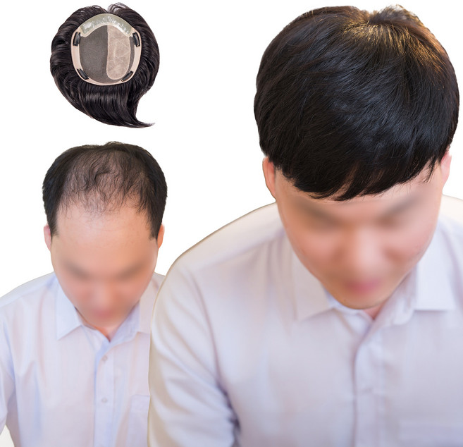 남자 정수리가발 부분가발 나노스킨, S(16x18cm), 1개