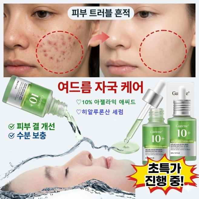 Gurene 인조이 스킨 아젤라익 애씨드 10% + 히알루론산 세럼, 1개, 30g