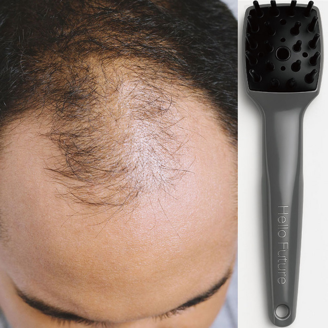 두피케어 안마기 관리기 마사지기 헬로퓨처 모낭 두피관리 각질 지압 헤어부스터, 2+1