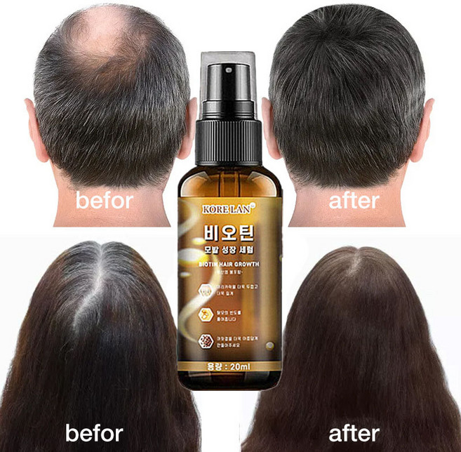 탈모 치료/머릿결개선/모발 강인화, 1개, 20ml