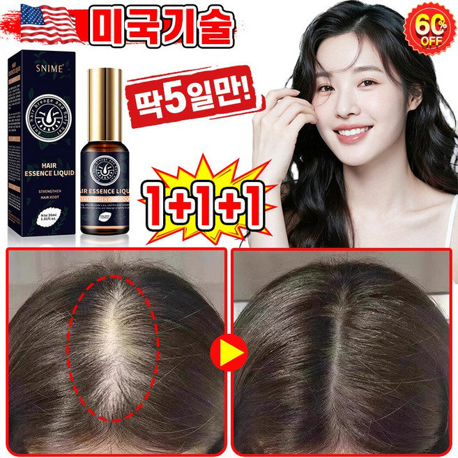 [빠른효과] 미국기술 1/1+1/2+2 두피 영양제 머리 발모제 모발 성장 촉진 에센스 탈모 방지 완화 두피케어 세럼 포장증정, 3개, 30ml