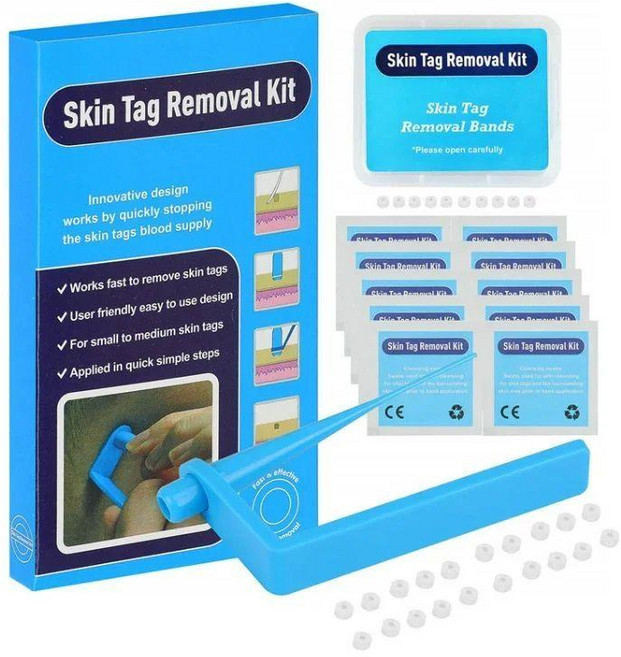 점빼기 세트 가정용 업그레이드 60개 고무 링 포함 미용 스킨케어 푸른 펜 2개 제거기