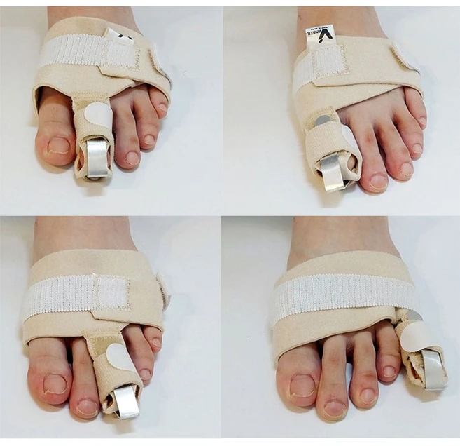 의료기기 발가락 골절 깁스 보호대 고정 지지대, 1개 - 쿠팡