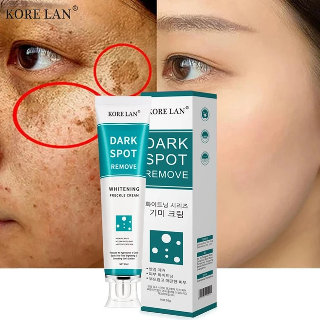 국내출하 (당일발송) 검버섯 황갈반 크림 미백크림, 20g, 1개 - 쿠팡