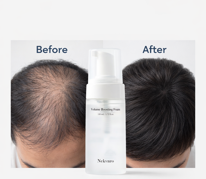 스칼프 부스팅 두피 탈모 앰플 부스팅 앰플 카페인 헤어 인핸싱 폼 두피 모발 헤어 토닉 앰플 영양제 탈모 헤어토닉 두피 앰플 여성 탈모 앰플로게인폼 정수리탈모 헤어라인 앰플, 2개, 110ml