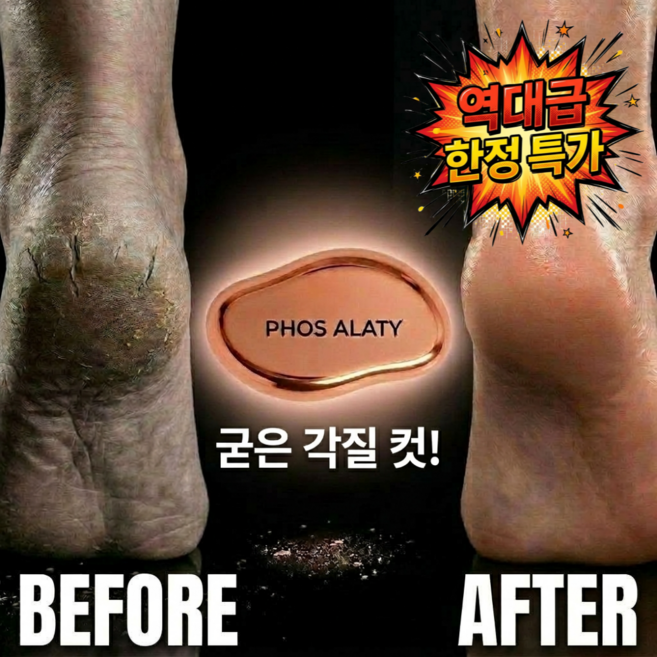 포스알라티 발각질제거기 스톤 명품, 60g, 1개, 1개입