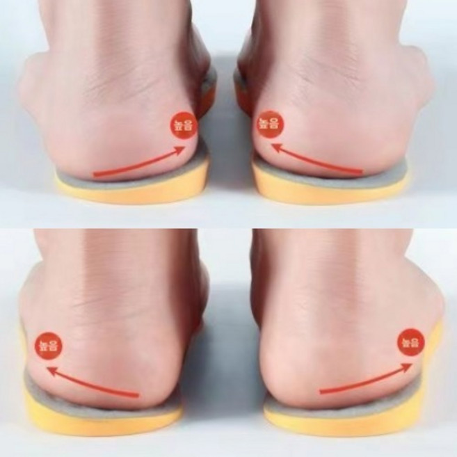 다리 교정 깔창 오자다리 팔자걸음 골반틀어짐 자세교정 발 아치 서포트 신발 안창 인솔, B 내측높은275