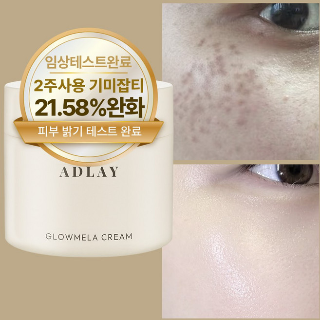 아들레이 화이트닝 색소침착 기미 주근깨 잡티 착색 미백크림, 1개, 70ml