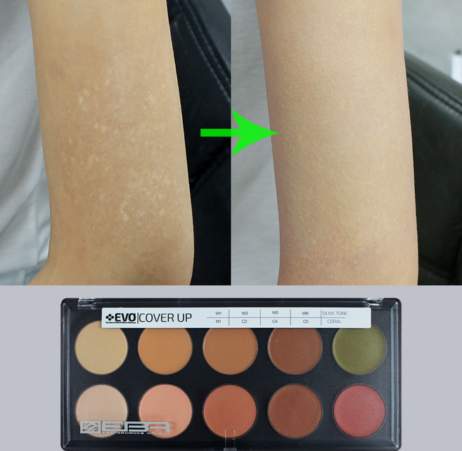 백반증커버 evo 크림 팔레트 10컬러 구성 흉터커버, 1개, evo 크림 팔레트 Cover up