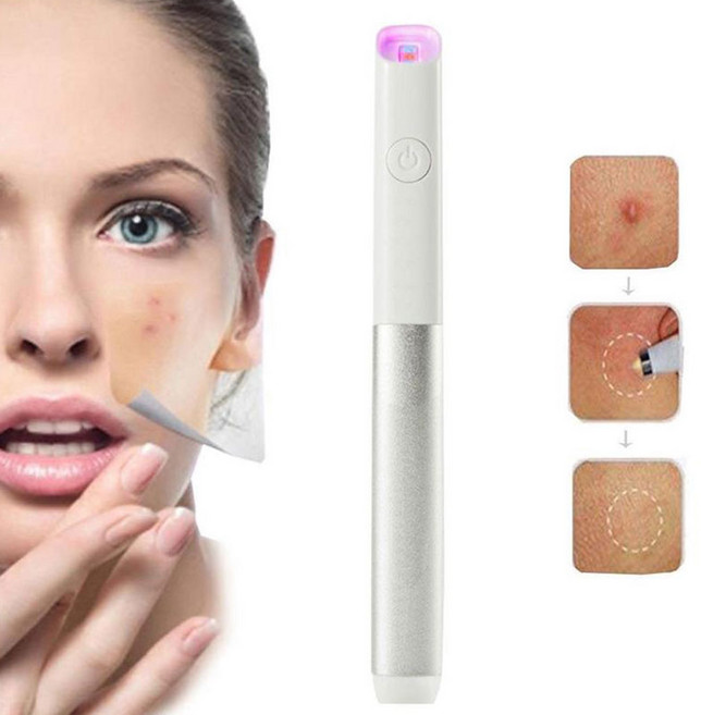 물때클리너 물때제거제 블루 라이트 레드 테라피 여드름 스팟 트리트먼트 레이저 펜 블랙헤드 블레미쉬 리무버 흉터 주름 제거 장치 뷰티 건강, 은, 1개