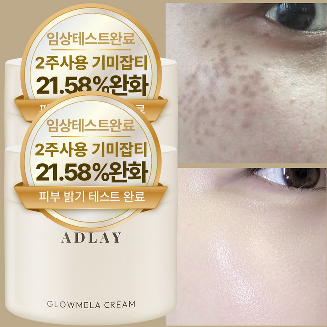 아들레이 화이트닝 색소침착 기미 주근깨 잡티 착색 미백크림, 2개, 70ml