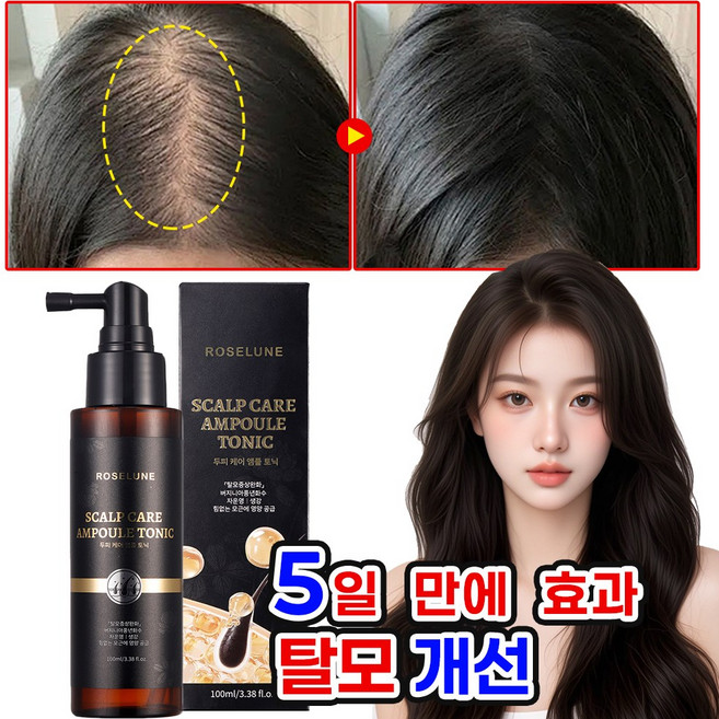 [국내배송] 머리카락 발모제 탈모앰플 모발 성장 촉진 두피 에센스 탈모 방지 완화 세럼 부스터 전문 케어 헤어 영양제, 1개, 100ml