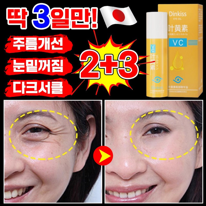 [3일만 효과보장] 1+1 루테인 VC 아이 리프팅 롤러 세럼 눈가주름 눈밑꺼짐 다크서클 아이크림 눈밑지방 제거 크림 포장 랜덤 출고, 5개, 8ml