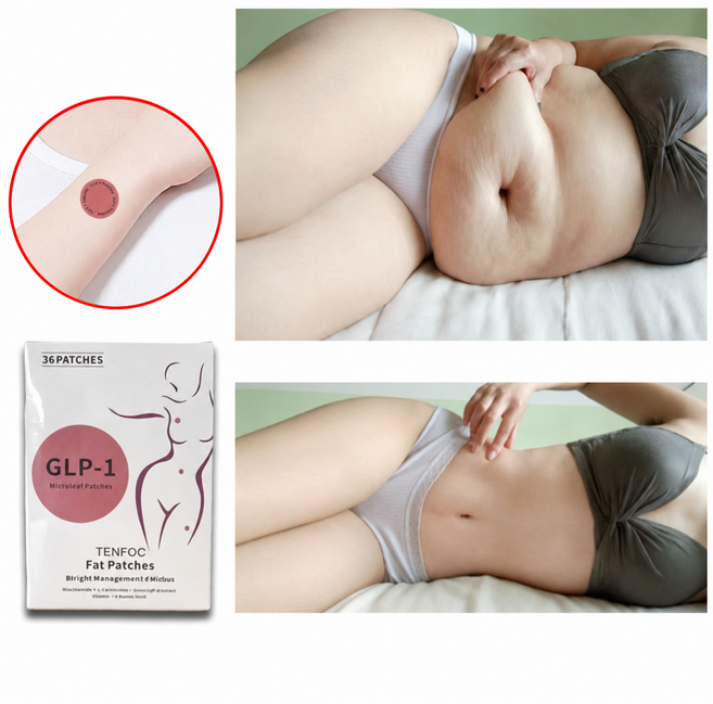SUOSER 다이어트 패치 붙이는 뱃살 다이어트 지방분해 식욕억제 패치 독소 제거 팔뚝살 허리 다리 복부 허벅지 군살 관리 패치 36pcs, 1개, 36개입
