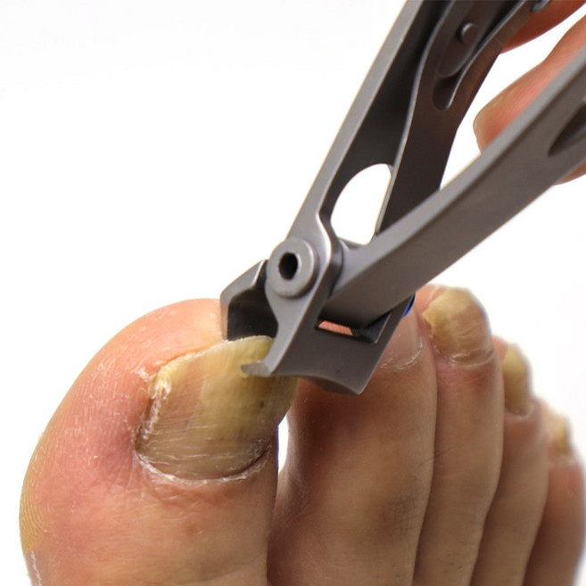 발톱무좀 두꺼워진 발톱전용 발톱깎이 세트, 1세트, 두꺼운발톱 전용발톱깎이