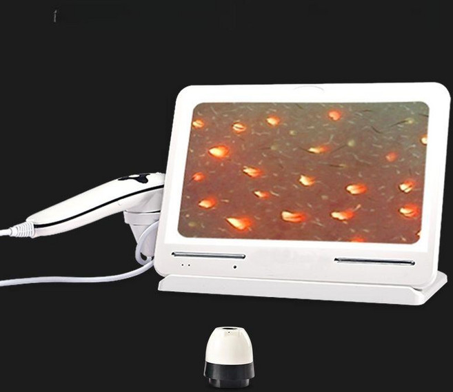 두피진단기 두피카메라 모낭 단품 확대경 현미경 피부 분석 디지털 무선 고화질 헤어, 단일 삼중, 기본 모델명/품번