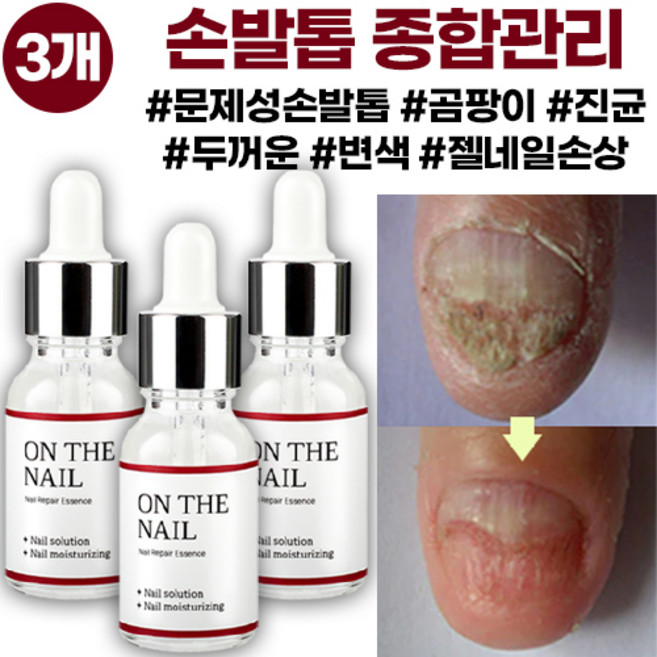비비룩 온더네일 에센스, 20ml, 3개