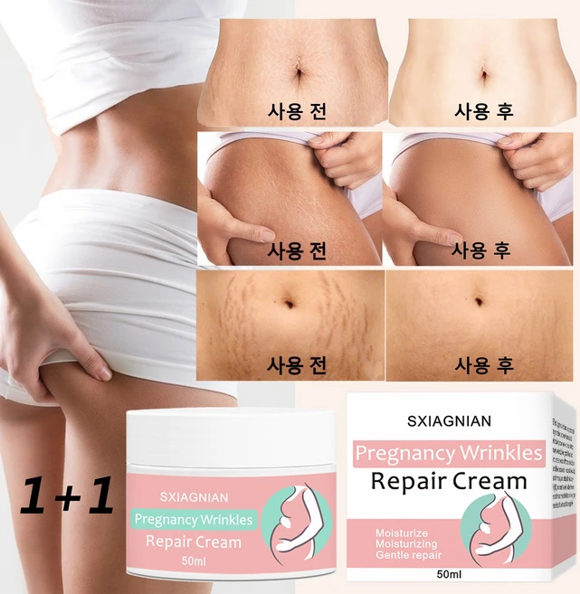 (한국셀러/본토출하) 산전후 튼살 생장문 탄력케어 크림 임산부 청소년 이용가능, 2개, 50g - 쿠팡