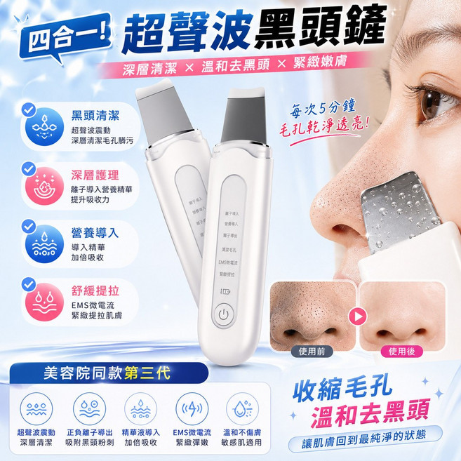四合一黑頭清潔鏟 粉刺機 黑頭清潔器 吸黑頭神器 黑頭儀 去黑頭鏟 清潔儀 黑頭清潔鏟, 毛孔護理清潔1個裝, 白色, 四合一超聲波祛頭