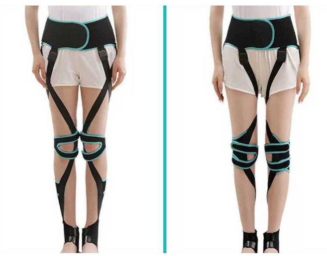 오다리 교정기 O자 X자 휜다리 자세 교정 보정 밴드, 1개