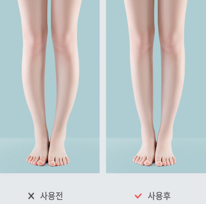 카멜리안 오다리 휜다리 교정 깔창 2p 3p 6p 10p 세트, 10세트