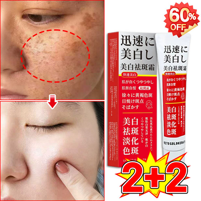 [피부과 추천] 멜라논 멜라닌 크림 기미크림 기미 잡티 검버섯 주근깨 제거 크림 착색 미백 크림 들깨기미크림 색소침착 화이트닝크림 LUPEIYA, 4개, 38g