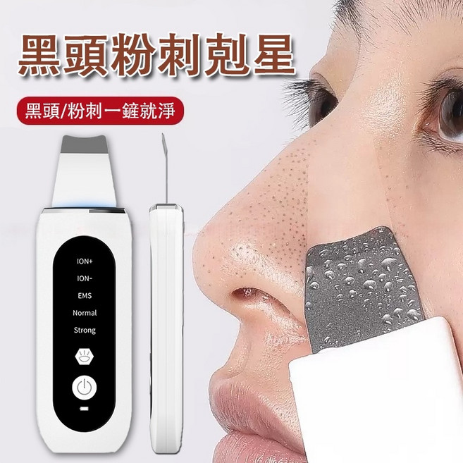 黑頭剷粉刺機 EMS 超音波毛孔清潔儀, 1個, 白色