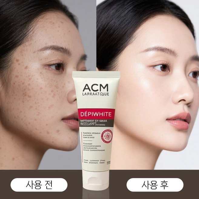 멜라논 크림 기미 잡티 제거 멜라논 크림 착색크림 기미 잡티 검버섯 제거 얼굴 색소침착 착색 화이트닝 피부 재생크림, 3개, 40g