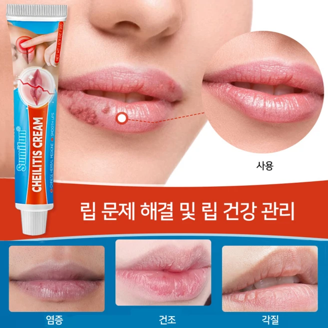 입술포진 연고 긴급구호 S-09, 20g, 1개, 20g - 쿠팡