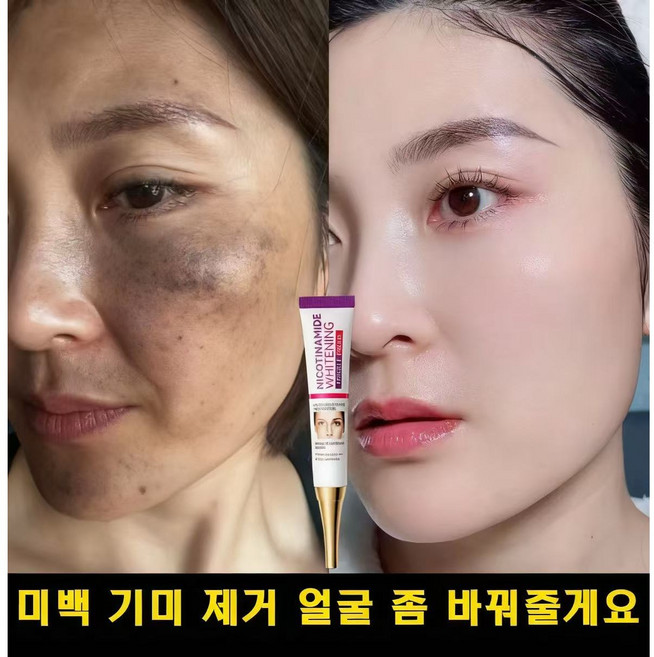 [일본기술]잡티 제거 기미 잡티 검버섯 제거 얼굴 색소침착 안티에이징, 2개, 20g
