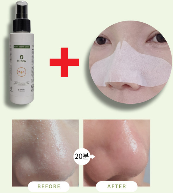 [에스지엔바이오] Dr.SGN 슈퍼클리어엑스로션 100ml+코솜 20매 저자극성 피지연화제 전용 초밀착 코화장솜 증정