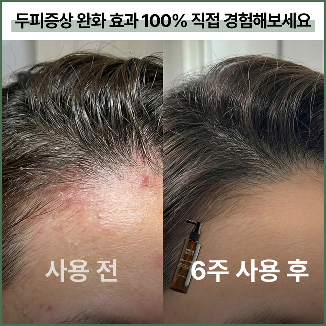 동의모감 창포 모근비책 두피토닉 헤어토닉 탈모 한의사 케어 두피 각질 비듬 쿨링 토너